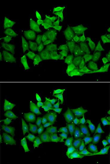 TTF / RHOH Antibody