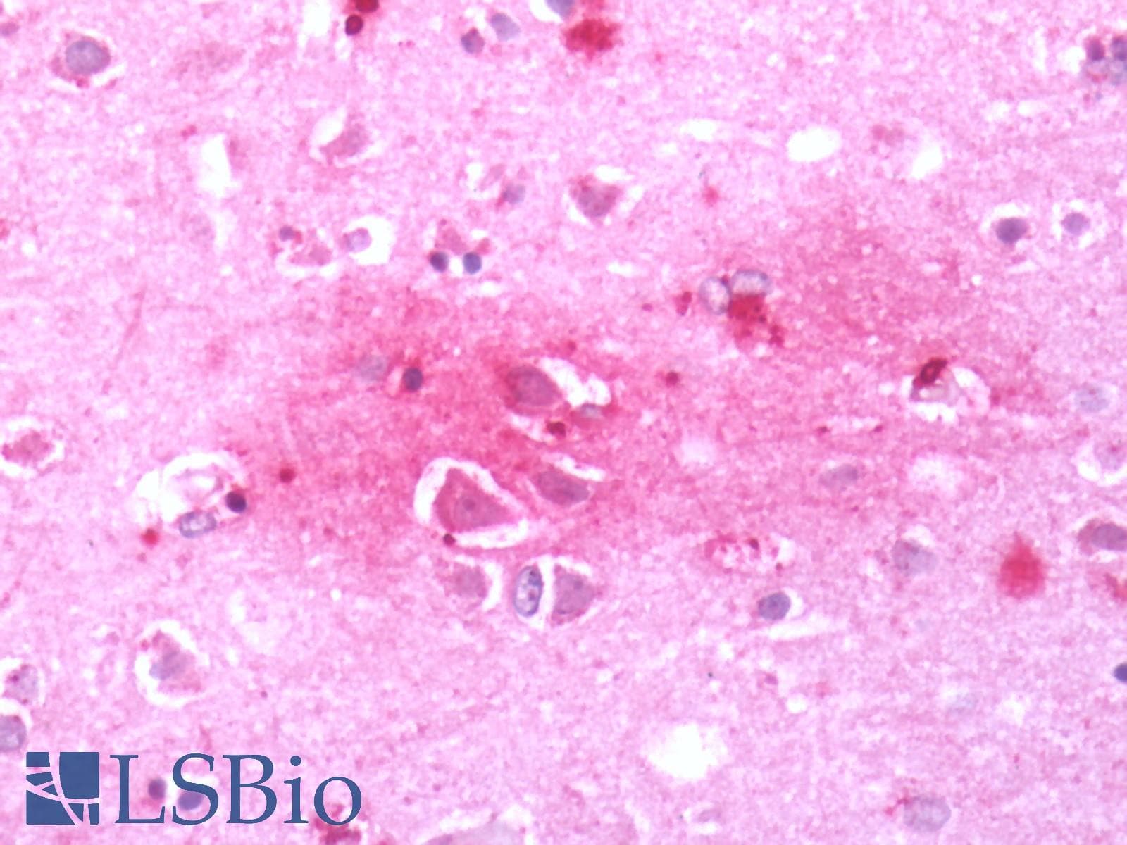 PathPlus™ CRFR1 / CRHR1 Antibody (N-Terminus)