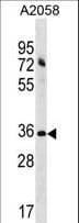 Polyclonal Rabbit anti-Human ACBD6 Antibody (aa52-78, WB)