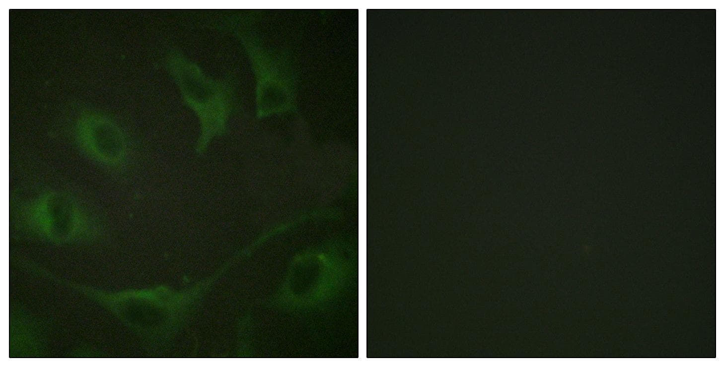 c-CBL Antibody (phospho-Tyr774)