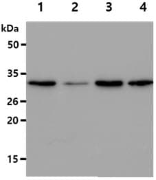 GSTT2 Antibody (clone AT10H4)