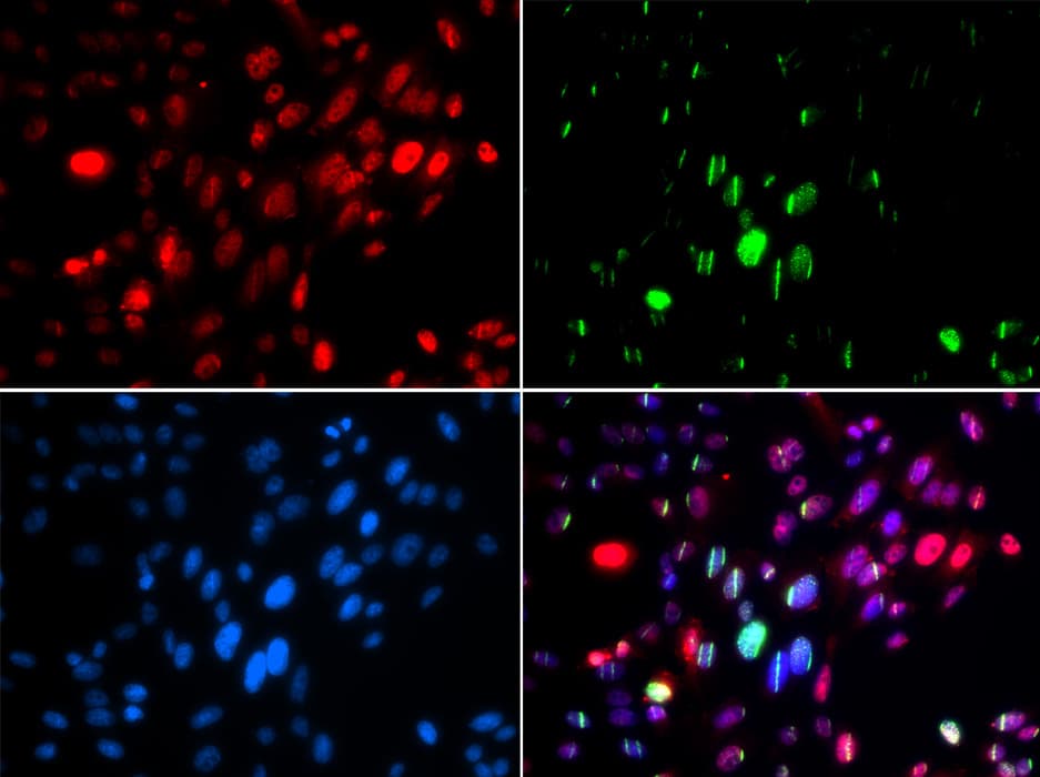 Polyclonal Rabbit anti-Human ABL1 / c-ABL Antibody (phospho-Tyr204, IF, WB)