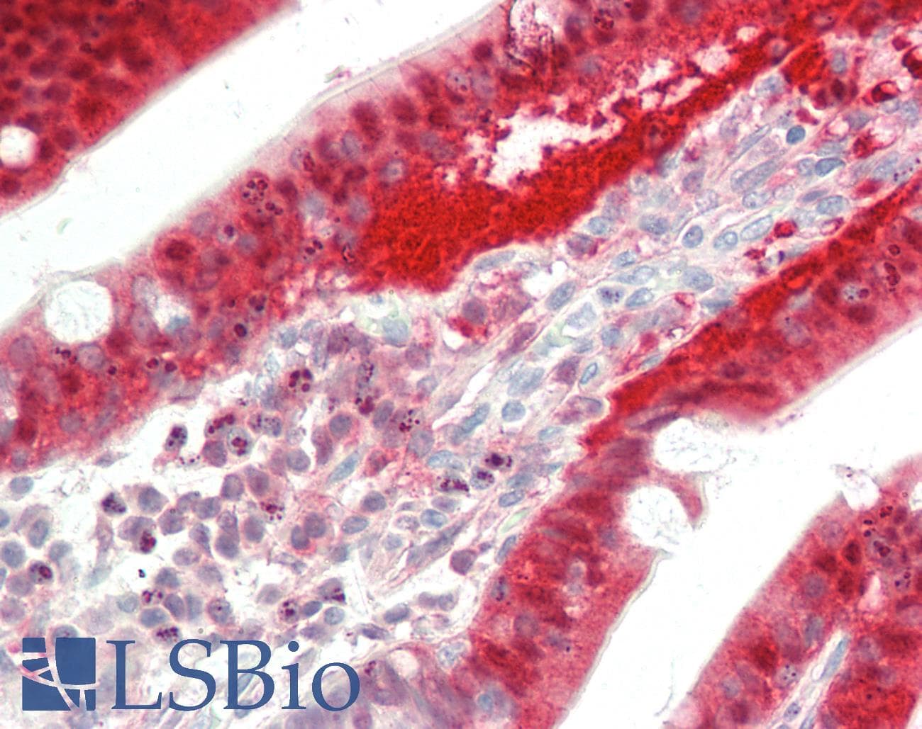 IHC-plus™ I-FABP / FABP2 Antibody (clone 2C4)