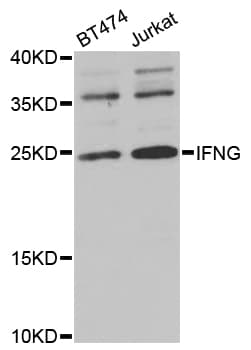 Polyclonal Rabbit anti-Human IFN Gamma / Interferon Gamma Antibody (IHC, WB)