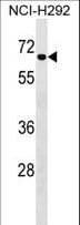 DYRK4 Antibody (aa335-363)
