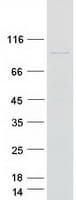 Human EXOC6 / SEC15 Protein (Recombinant Myc-DDK (Flag))