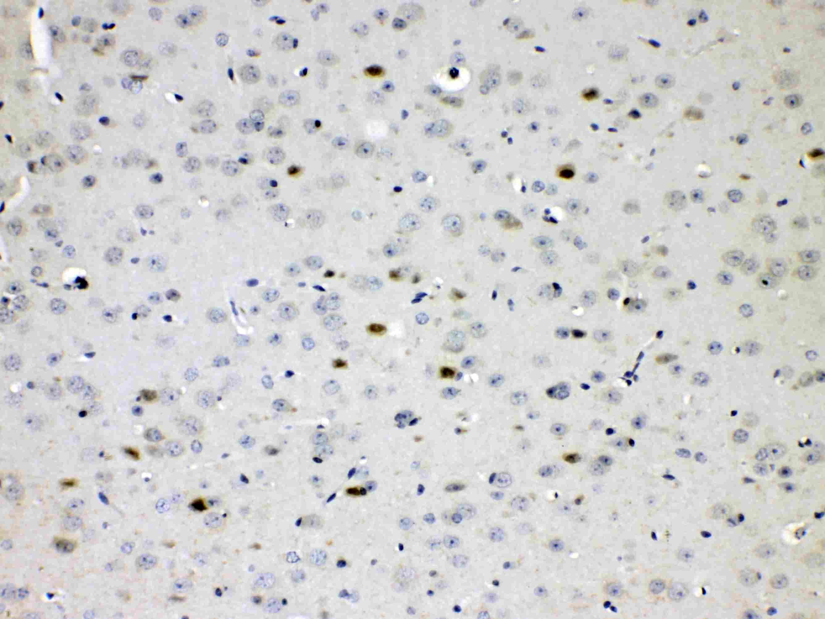 Polyclonal Rabbit anti-Human CHAT Antibody (IHC, WB)