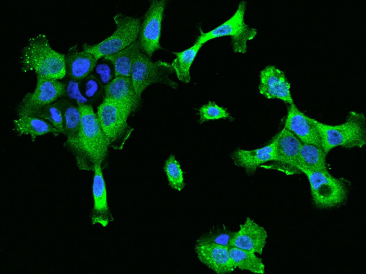 CTTN / Cortactin Antibody