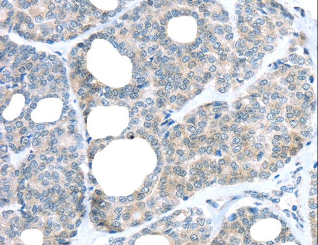 RAB24 Antibody