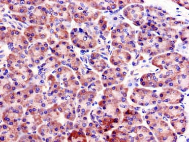 Polyclonal Rabbit anti-Human FBX09 / FBXO9 Antibody (IHC, IF)