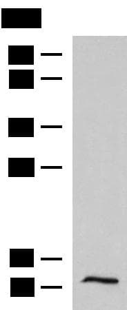 PCBD1 / PHS Antibody