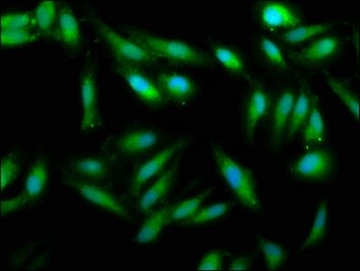 UMPS / OPRT Antibody