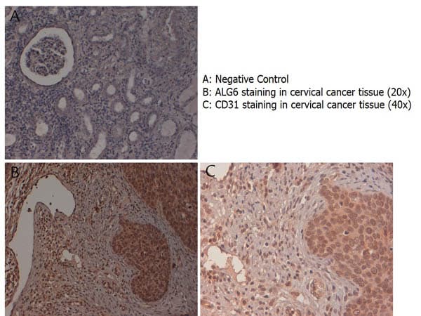 CDG1C / ALG6 Antibody (N-Terminus)