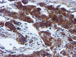 EPN2 Antibody (clone OTI1E4)
