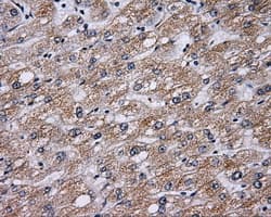 BTK Antibody (clone OTI12D4)