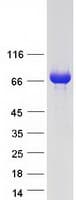 Human KBTBD10 / Sarcosin Protein (Recombinant Myc-DDK (Flag))