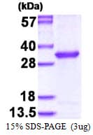 Human OVCA2 Protein (Recombinant His)