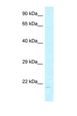 Polyclonal Rabbit anti-Human ARL6IP1 / ARMER Antibody (C-Terminus, WB)