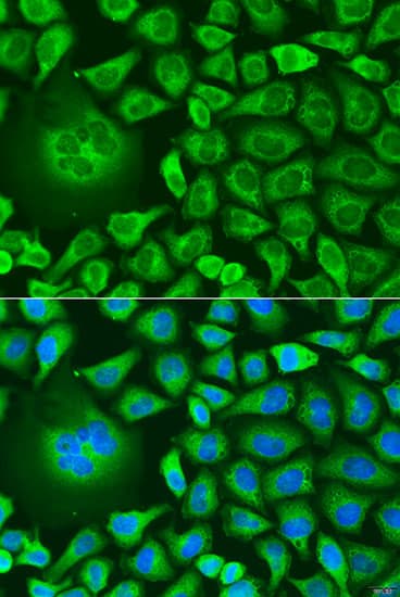 Polyclonal Rabbit anti-Human TERE1 / UBIAD1 Antibody (IF, WB)