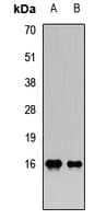 PLA2G2A / SPLA2 Antibody