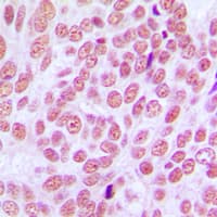 Polyclonal Rabbit anti-Human CCDC102B Antibody (Internal, IHC, WB)