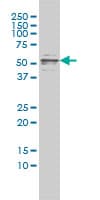 IHC-plus™ CFLAR / FLIP Antibody (clone 2F12)