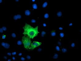 CAPN9 / Calpain 9 Antibody (clone OTI1C2)