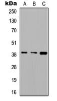 Polyclonal Rabbit anti-Human ALDOC / Aldolase C Antibody (Internal, IHC, WB)