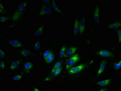 IHC-plus™ Polyclonal Rabbit anti-Human RPL38 / Ribosomal Protein L38 Antibody (IHC, WB)