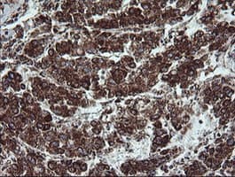 NDUFB9 Antibody (clone OTI3A1)