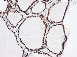 NUDT18 Antibody (clone OTI5D7)