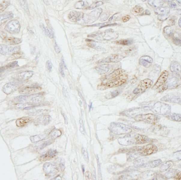APC Antibody (aa1-50)