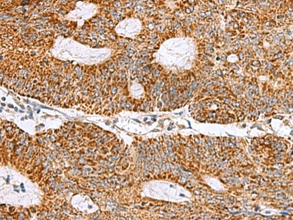 Polyclonal Rabbit anti-Human MRPS28 Antibody (IHC, WB)