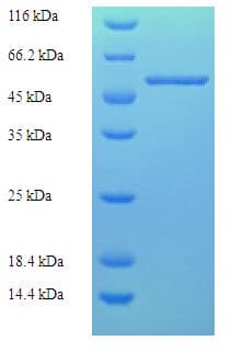 Borrelia burgdorferi fla Protein (Recombinant His-SUMO)