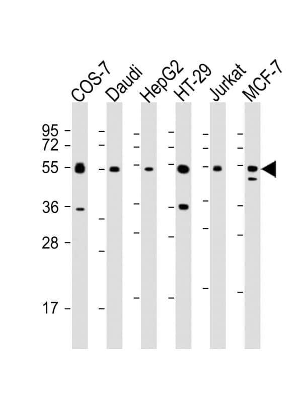 IRF3 Antibody (clone 1522CT766.58.24)