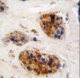 Vimentin Antibody (aa152-181)