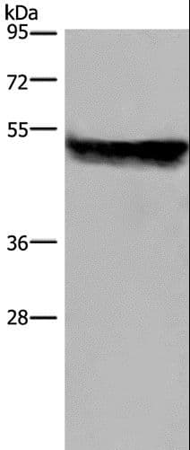 CYP2E1 Antibody