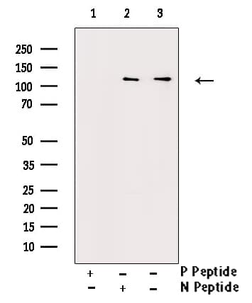 c-CBL Antibody (phospho-Tyr674)