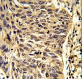 SNRPD1 / SMD1 Antibody (aa46-78)