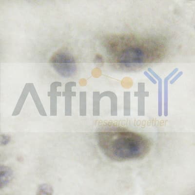 MAP3K8 / TPL2 Antibody