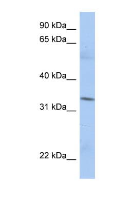 MRPL15 Antibody (aa35-84)