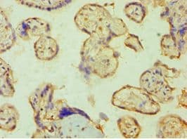 PPP3CC / CALNA3 Antibody (aa373-512)
