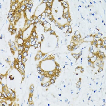 SIRT2 / Sirtuin 2 Antibody