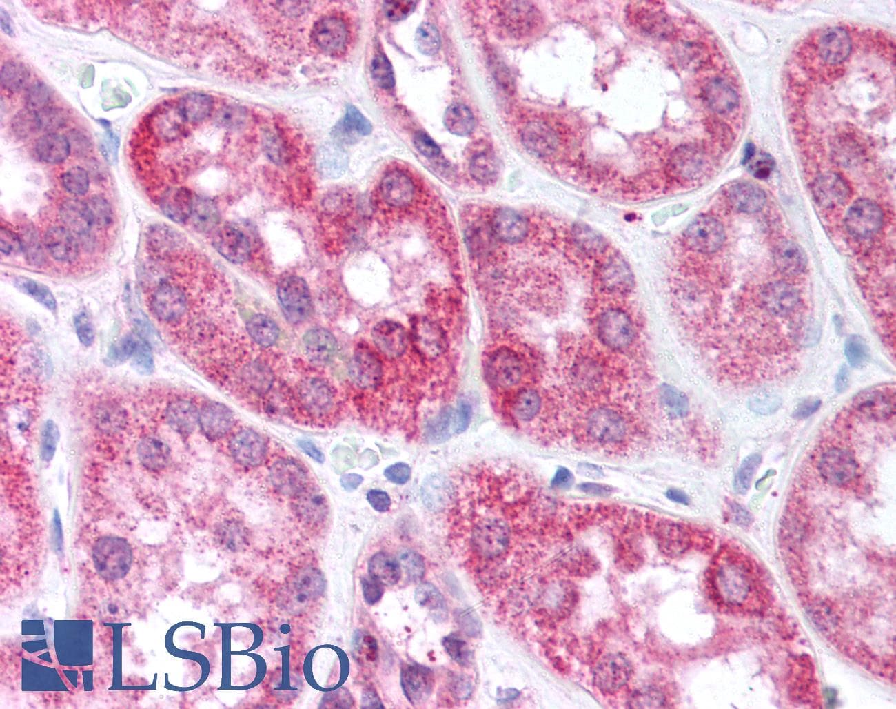 IHC-plus™ PLIN3 / M6PRBP1 / TIP47 Antibody (aa1-100)