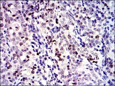 BIRC5 / Survivin Antibody (clone 1H5)