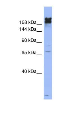 Polyclonal Rabbit anti-Human NES / Nestin Antibody (aa1295-1344, IHC, WB)