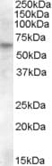RPE65 Antibody (aa352-364)