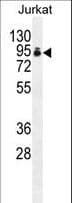 PAPOLA Antibody (aa407-435)