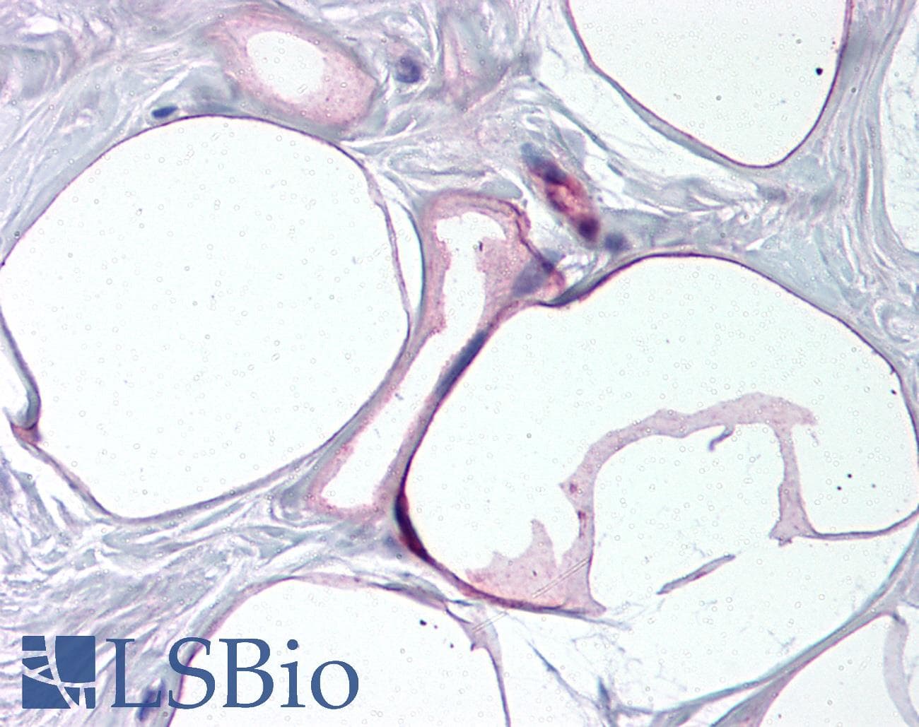 IHC-plus™ FABP4 / AP2 Antibody (aa103-118)