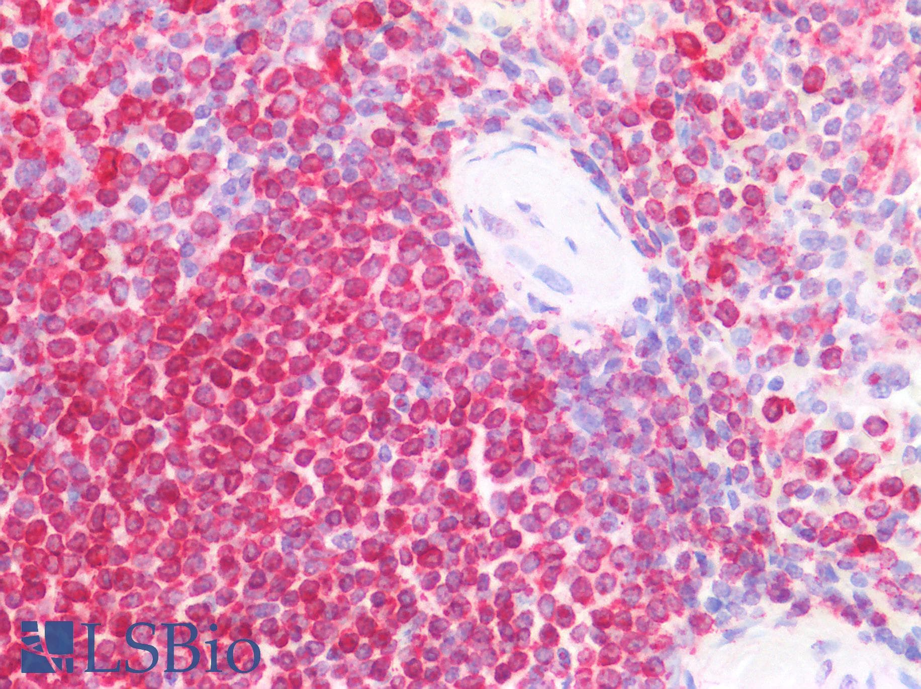 IHC-plus™ CD74 / CLIP Antibody (Internal Region)